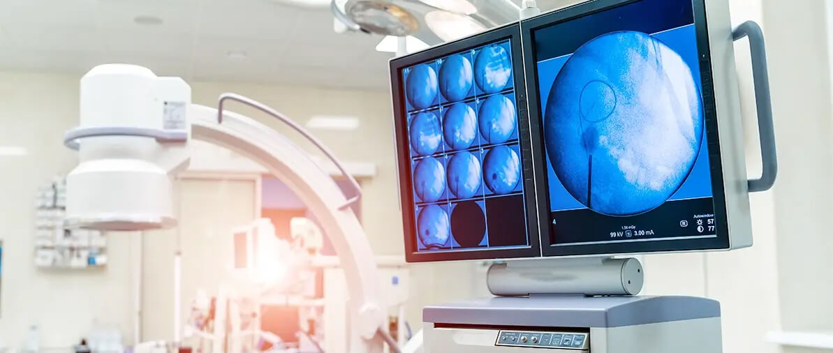 OLED displays in industrial applications